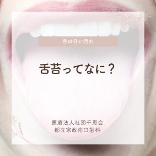 こんにちは🌟
都立家政南口歯科です🦷

舌の上に白い汚れがついているのを見たことはありませんか？

その正体は「舌苔（ぜったい）」です💡
細菌のかたまりで、口臭や味覚障害の原因になることがあります😳

間食や口呼吸、歯みがき不足は舌苔がつきやすくなる原因に💦
気になる方は歯科でのチェックやケアがおすすめです🌿

また、次回の投稿で対処法も参考にしてみましょう👀✨

🦷【都立家政南口歯科】🦷
〒165-0033
住所:東京都中野区若宮3丁目17−6　メゾンドグリシーヌ1F

#都立家政南口歯科#東京都#中野#中野の歯医者さん#歯科医院#歯科医師#歯科衛生士#舌苔