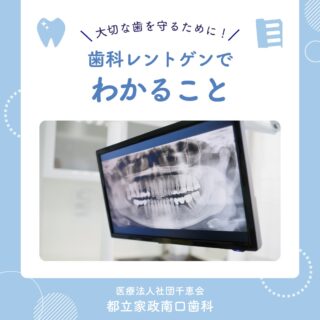 こんにちは🌟
都立家政南口歯科です🦷

歯科医院で行うレントゲン検査では、
実はたくさんのことがわかります📸

肉眼では見えない
✔ 虫歯
✔ 歯周病による骨の減少
✔ 親知らずの位置
✔ 歯の亀裂や根の感染

などを確認することができます💡

早期発見・早期治療のためにも
定期的なチェックが大切です🪥✨

🦷【都立家政南口歯科】🦷
〒165-0033
住所:東京都中野区若宮3丁目17−6　メゾンドグリシーヌ1F

#都立家政南口歯科 #中野の歯医者さん #東京歯医者
#歯科レントゲン #予防歯科 #西武新宿線 #西武新宿線歯医者 #都立家政駅
#都立家政歯医者 #中野区若宮 #中野区鷺ノ宮