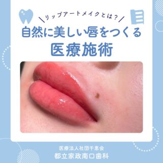 こんにちは🌟
都立家政南口歯科です🦷

当院では、リップアートメイクを導入しました💋✨

リップアートメイクの気になるあれこれについて、
詳しくご紹介しています😊🌿

当院では現在、モニターキャンペーンを実施しています💡

通常費用は12万円（税込）ですが、
モニターの場合8万円（税込）でご案内しております(先着3名残り2名)✨

これを機に、ぜひお試しくださいね😊

まずはお気軽にカウンセリングへお越しください🌸

🦷【都立家政南口歯科】🦷
〒165-0033
住所:東京都中野区若宮3丁目17−6　メゾンドグリシーヌ1F

#都立家政南口歯科 #中野の歯医者さん #東京歯医者 #歯の豆知識
#虫歯予防 #西武新宿線 #西武新宿線歯医者 #都立家政駅
#都立家政歯医者 #中野区若宮 #中野区鷺ノ宮
