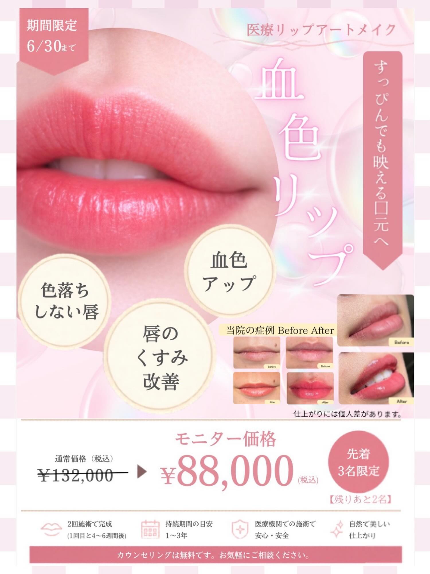 こんにちは⭐️
都立家政南口歯科です🦷
＝＝＝＝＝＝＝＝＝＝

🌸医療リップアートメイク モニター募集🌸

【先着3名限定】
✨残り2名✨

「唇のくすみが気になる」
「ノーメイクだと顔色が悪く見える」

そんなお悩みはありませんか？☺️

医療リップアートメイクで、
自然な血色感のある明るい口元へ💄✨

✔ 唇のくすみ改善
✔ 血色感アップ
✔ 色落ちしにくい
✔ メイク時間短縮

当院では歯科医院ならではの強みとして、
ご希望の方には浸潤麻酔を使用し、痛みに配慮した施術も可能です🦷✨

通常132,000円（税込）
⬇️
モニター価格 88,000円（税込）

気になる方は無料カウンセリングへ✨

#都立家政南口歯科 #中野区の歯医者 #リップアート #美容 #モニター募集 
＝＝＝＝＝＝＝＝＝＝
🦷【都立家政南口歯科】🦷
〒165-0033
住所:東京都中野区若宮3丁目17-6
メゾンドグリシーヌ1階